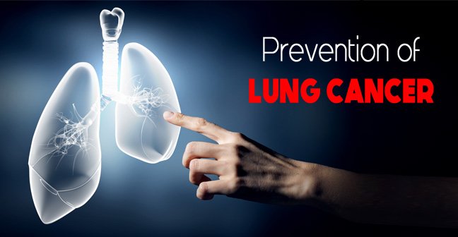 Lung Cancer Prevention – Knowing it better